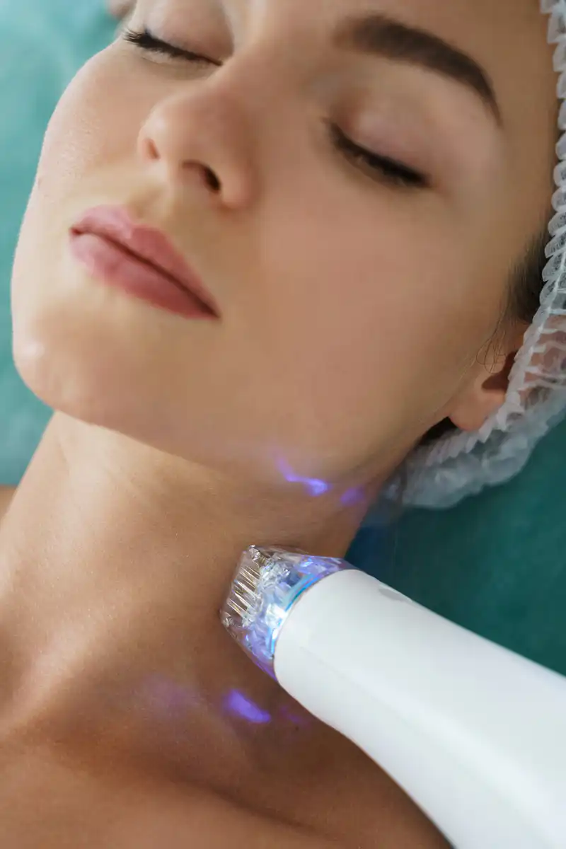 Εφαρμογή Fractional Laser στον λαιμό γυναίκας