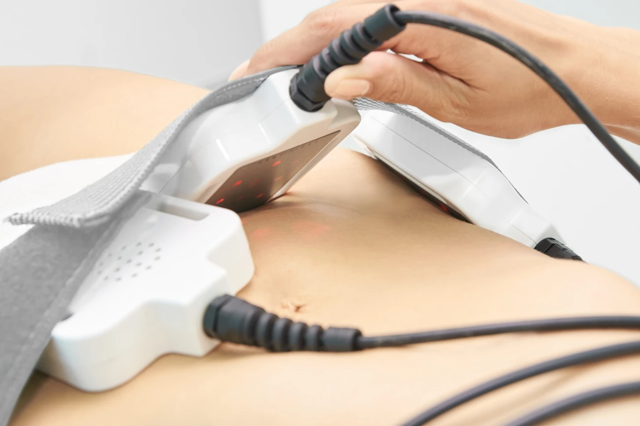 Θεραπεία lipolaser με συσκευή στην κοιλιά για μείωση τοπικού λίπους